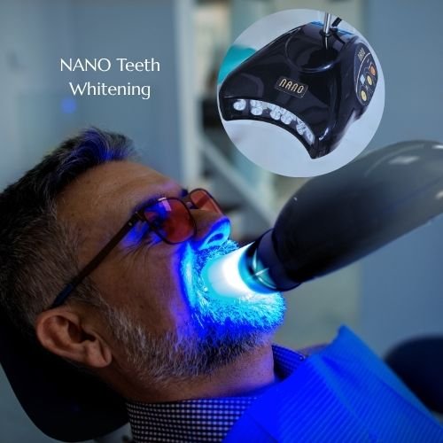 افضل جهاز تبييض للاسنان في ابوظبي شخبوط