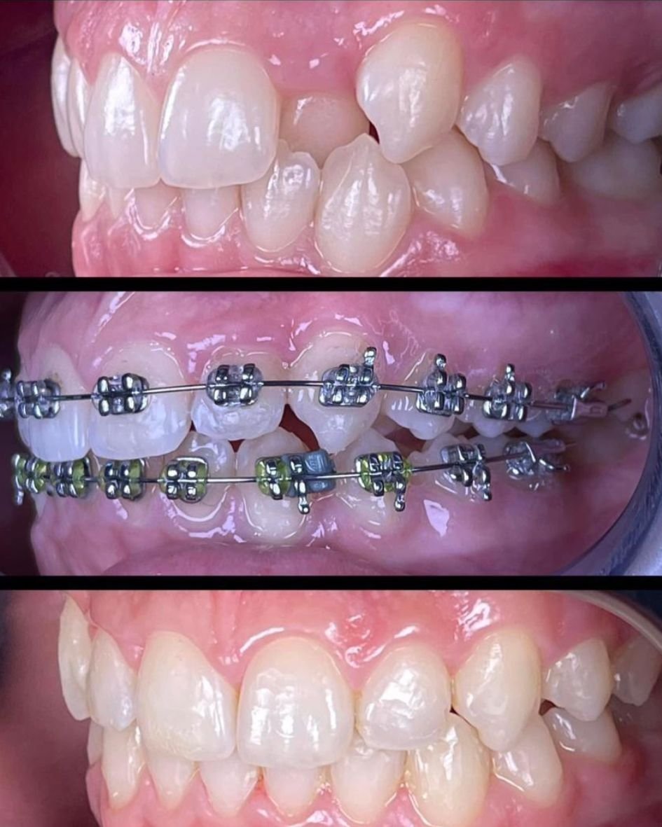 مركز أسنان حديث ومريح يقدم خدمات تقويم الأسنان في أبوظبي، الإمارات العربية المتحدة.