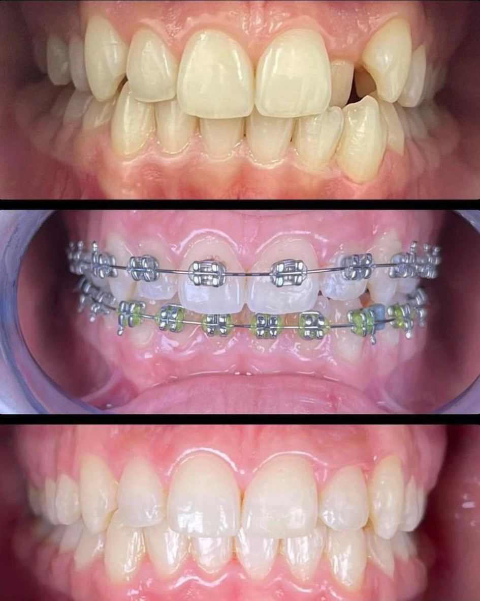 طبيب أسنان متخصص يقدم استشارة تقويم الأسنان في أبوظبي ويشرح خيارات العلاج.
