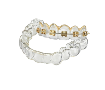 Teeth Braces Services in AbuDhabi